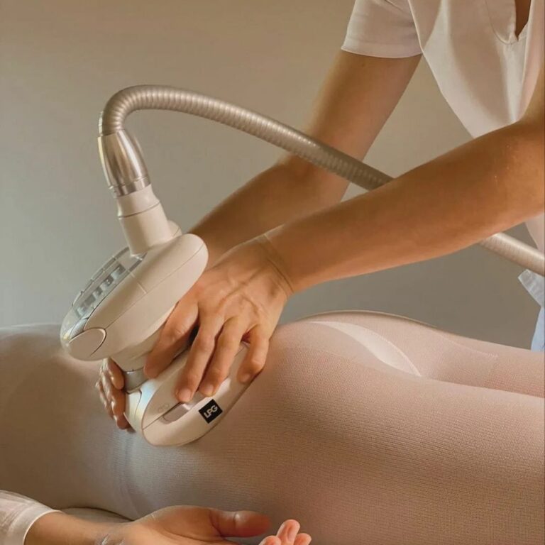 LPG 5
